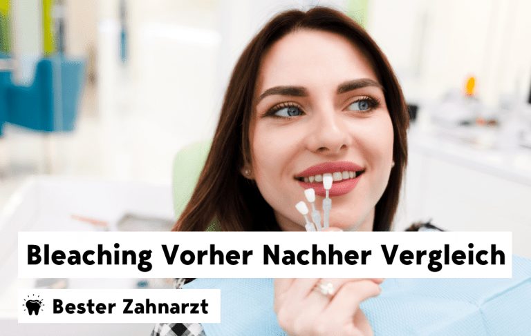 Bleaching Vorher und Nachher Vergleich beim Zahnarzt